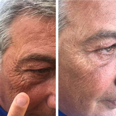 Rezultat InstanTENSE Plus