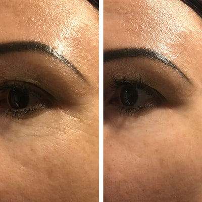 Rezultat InstanTENSE Plus